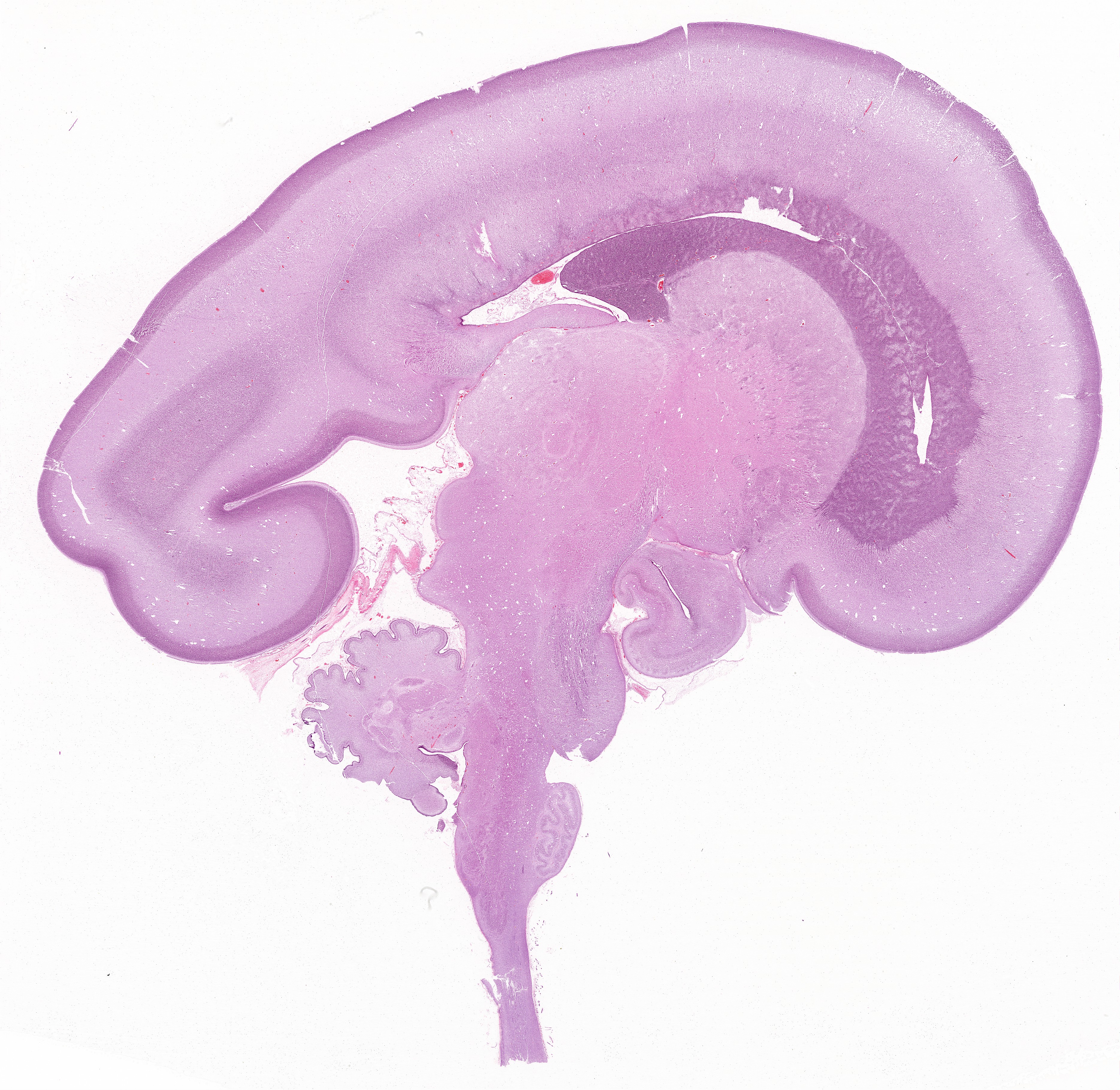 Fetal Brain H&E stained